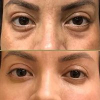 Client transformation result 08